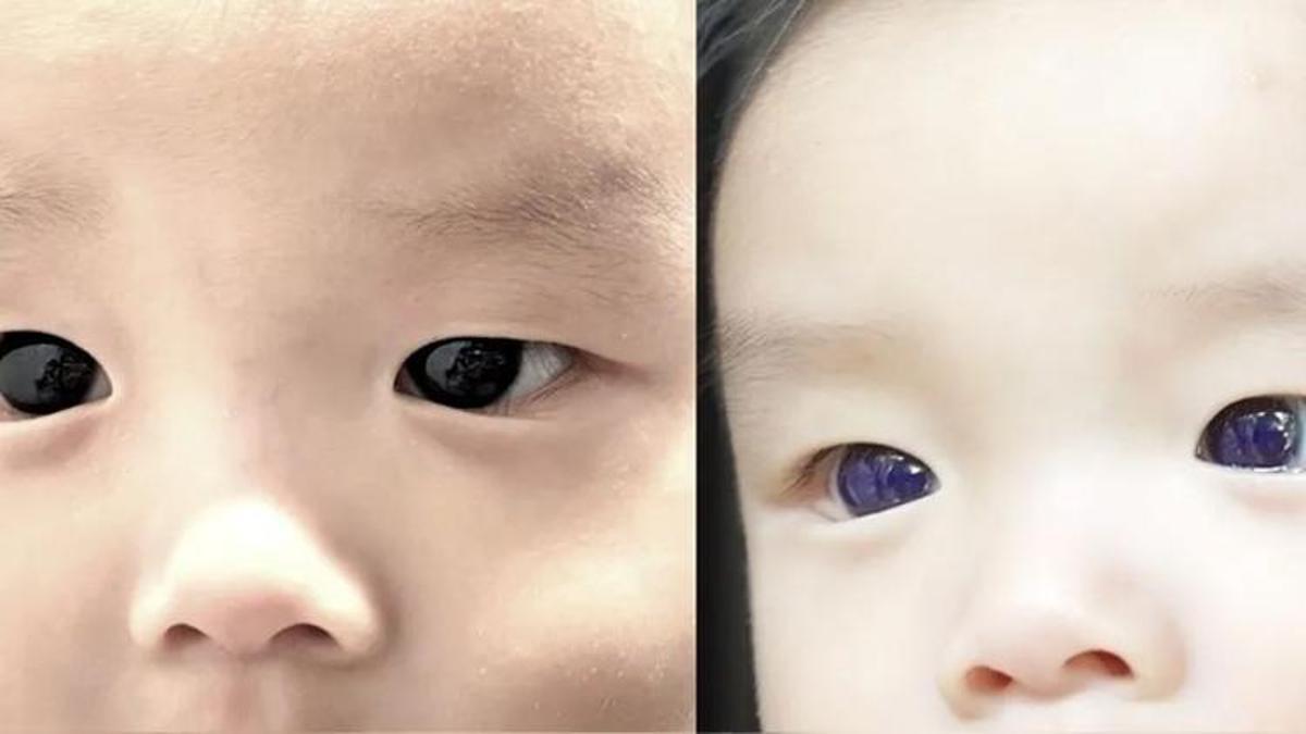 Şimdi 6 aylık! Koronavirüs tedavisine başlandı gözleri 18 saat içinde maviye döndü...