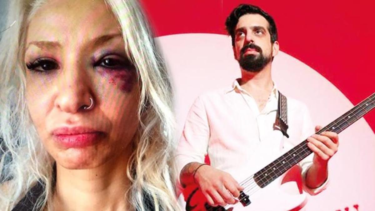 Şoke eden sav... Müzisyen Can Tunaboylu sevgilisi Aybike Çelik'e şiddet uyguladı!